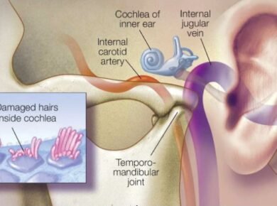 tinnitus ursachen